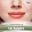 Lip Surgery Consultation